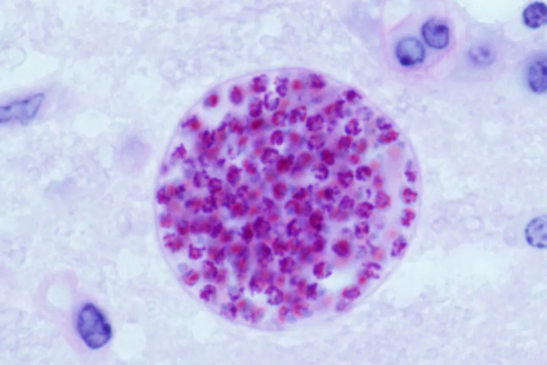 A tissue cyst filled with T. gondii parasites in the brain of a mouse. (Public Domain)