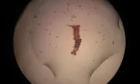 New Compounds May Promote Scar-Free Wound Healing, Animal Study Finds