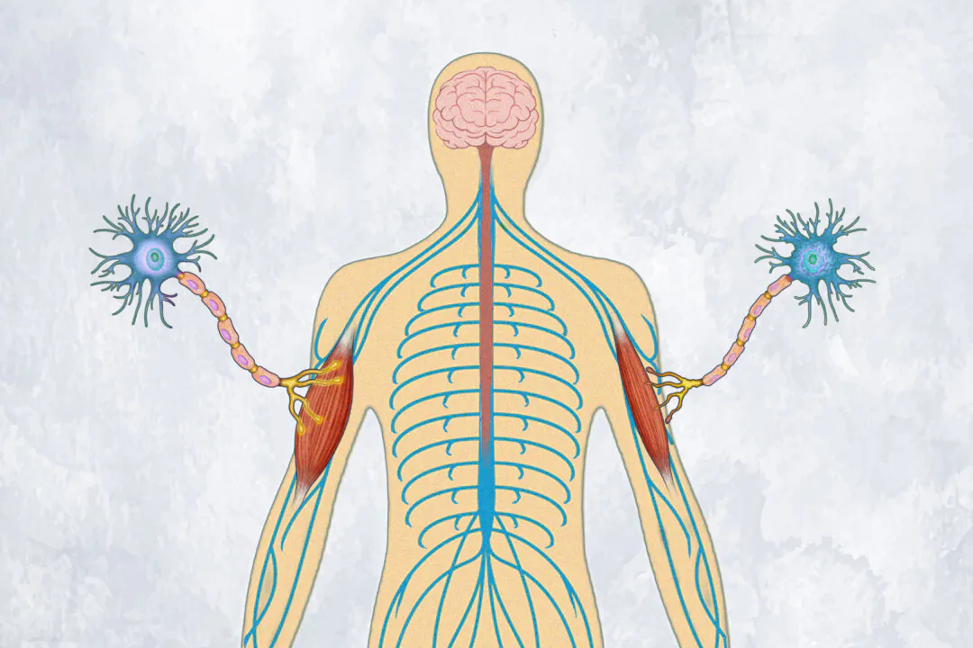 ALS causes progressive nerve cell degeneration, disrupting signals to muscles and leading to loss of muscle function. (Illustration by Fei Meng)