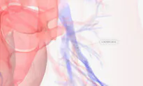 A Paper Clip-Sized Device Is Changing Heart Failure Treatment