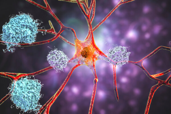 Increasing a Brain Protein May Slow Alzheimer’s Disease