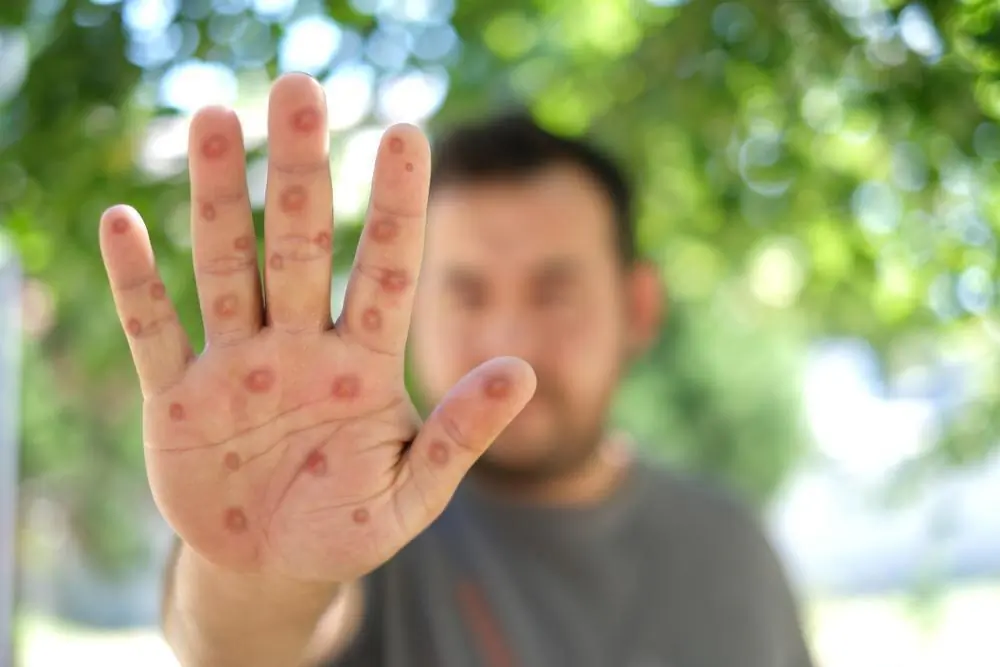 (Selman GEDIK/Shutterstock)