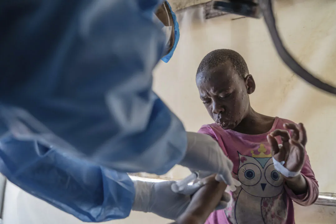 FILE - A health worker attends to an mpox patient, at a treatment center in Munigi, eastern Congo, on Aug. 19, 2024. (AP Photo/Moses Sawasawa, File)