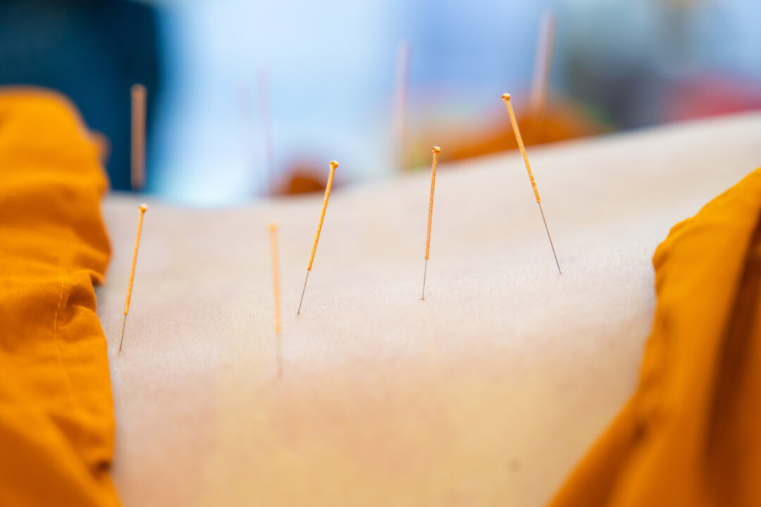 Most Common Conditions Relieved by Acupuncture