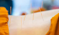 Most Common Conditions Relieved by Acupuncture