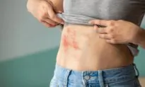 The Early Signs of Shingles and How to Treat the Condition