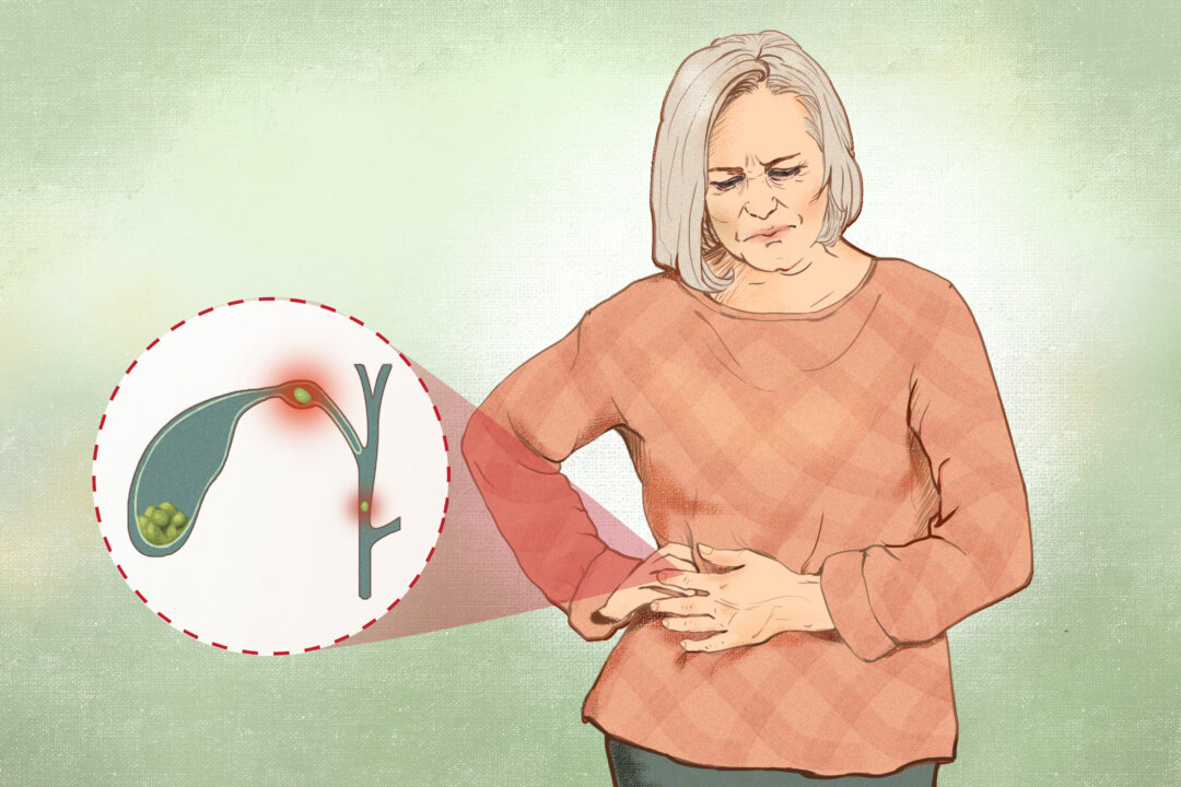 Gallstones: Symptoms, Causes, Treatments, and Natural Approaches