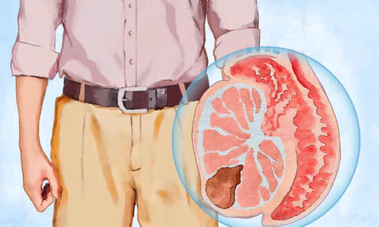 Testicular Cancer: Symptoms, Causes, Treatments, and Natural Approaches