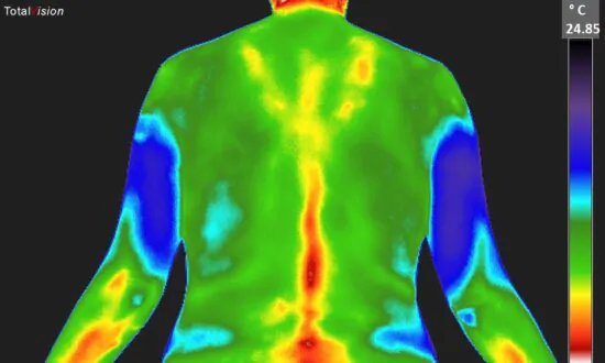 Thermography Versus Mammography: What You Need to Know About the Trending Screening