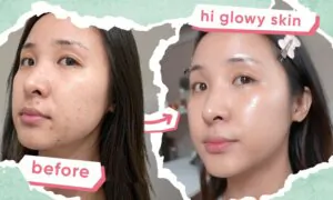 Affordable Korean Skincare Routine for Acne—Plus Must-Try Tips