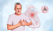 Aortic Stenosis: Symptoms, Causes, Treatments, and Natural Approaches