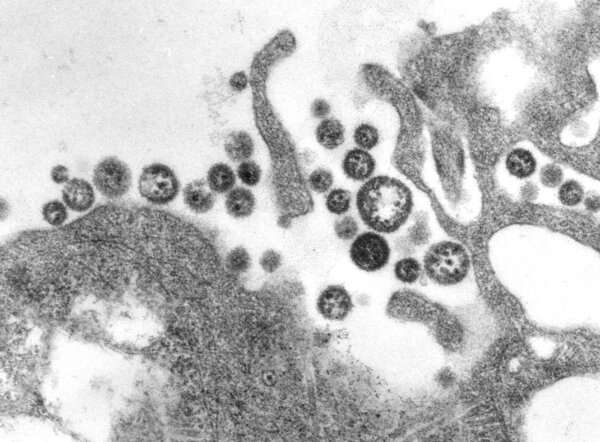 Death From Lassa Virus Reported in US