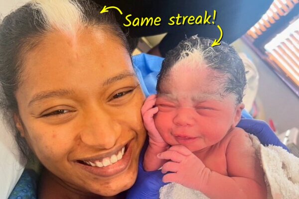 Mom Stunned After Newborn Daughter Born With Matching White Hair Streak