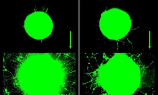 Muscle Workouts Stimulate Nerve Growth, Mice Study Finds