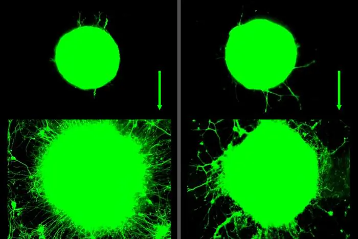 MIT scientists find that motor neuron growth increased significantly over 5 days in response to biochemical (Left) and mechanical (Right) signals related to exercise. The green ball represents cluster of neurons that grow outward in long tails, or axons. (Angel Bu)