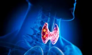 Thyroid Disorders: Natural Remedies and Treatment Options