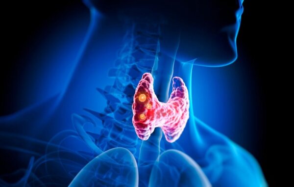 Thyroid Disorders: Natural Remedies and Treatment Options