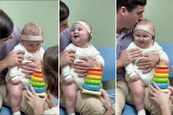 VIDEO: Baby Born Completely Deaf Hears His Parents' Voices for the First Time