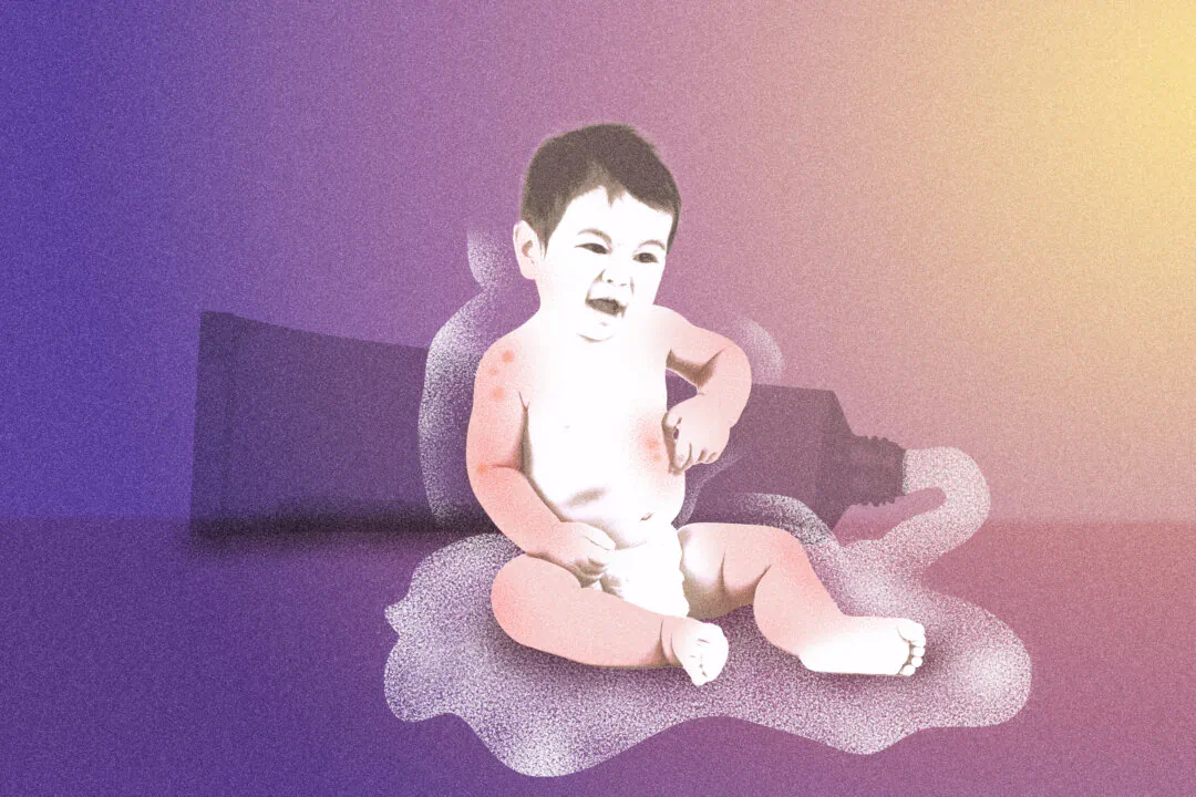 A growing cohort of parents, patients, and researchers are calling for wider recognition of topical steroid withdrawal. (Illustration by The Epoch Times, Shutterstock)