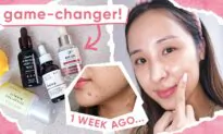Best Brightening Serums: Acne and Hyperpigmentation