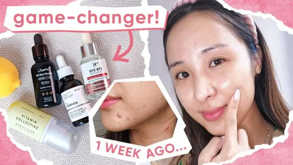 Best Brightening Serums: Acne and Hyperpigmentation