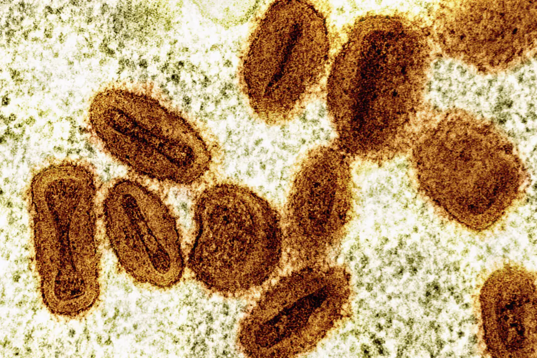 A colorized electron microscope image shows Mpox virus particles (orange) found within infected cells (green). (NIAID via AP)