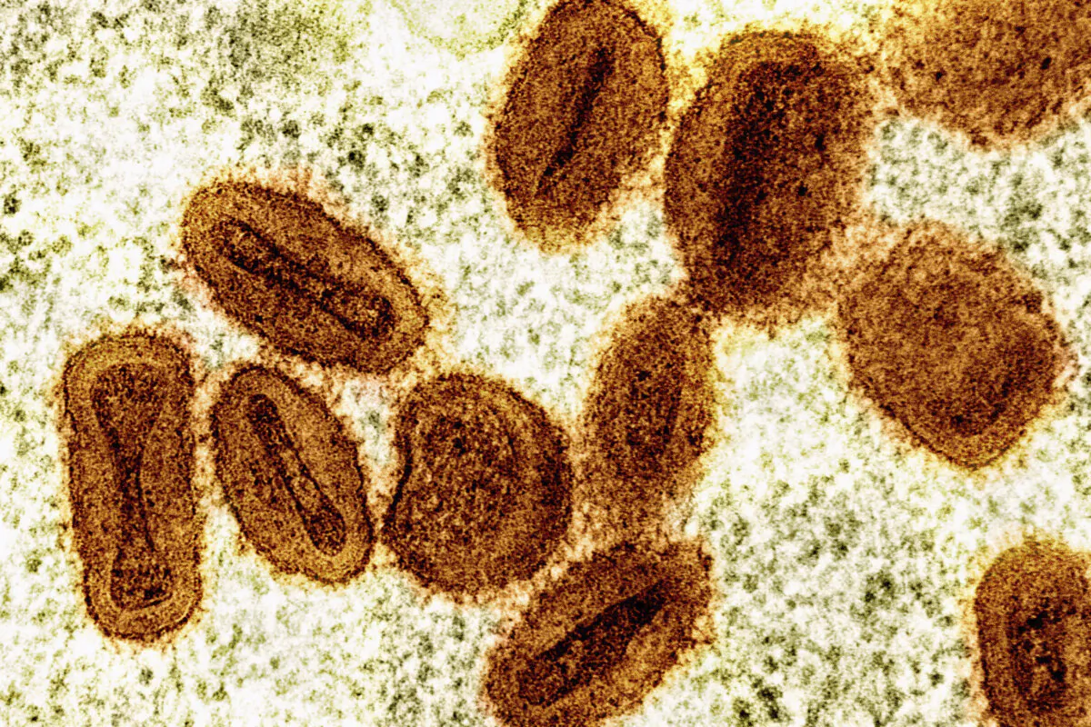 A colorized electron microscope image shows Mpox virus particles, orange, found within infected cells, green. (NIAID via AP)