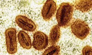 Monkeypox Smuggling Case Not the 1st Linked to China