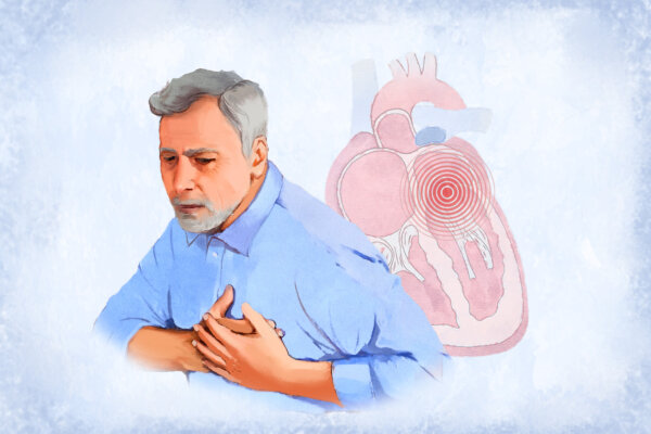 Mitral Valve Prolapse: Symptoms, Causes, Treatments, and Natural Approaches