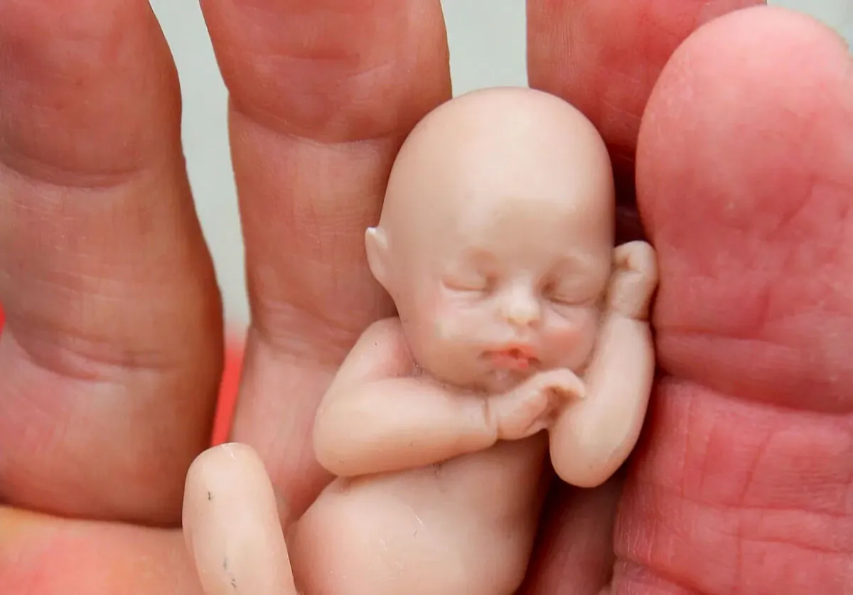 A pro-life person holds a model of a fetus while protesting in Aurora, Illinois, on Oct. 2, 2007. (Scott Olson/Getty Images)