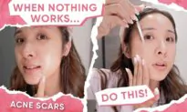 How to Really Fade Dark Spots That Aren’t Fading (Ft. Numbuzin)