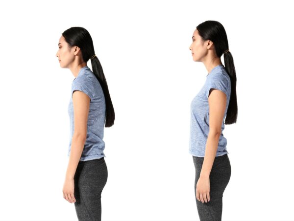 Health Risks of Hunchback Posture and Exercises to Improve It