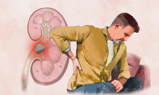 Kidney Stones: Symptoms, Causes, Treatments, and Natural Approaches
