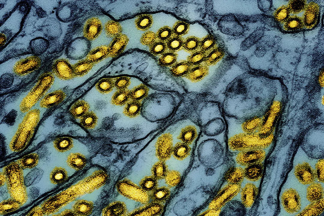 This colorized electron microscope image released by the National Institute of Allergy and Infectious Diseases on March 26, 2024, shows avian influenza A H5N1 virus particles (yellow), grown in Madin-Darby Canine Kidney (MDCK) epithelial cells (blue). (CDC/NIAID via AP, File)
