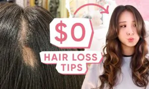 My $0 Hair Loss Tips—They Really Work! (Not Sponsored)
