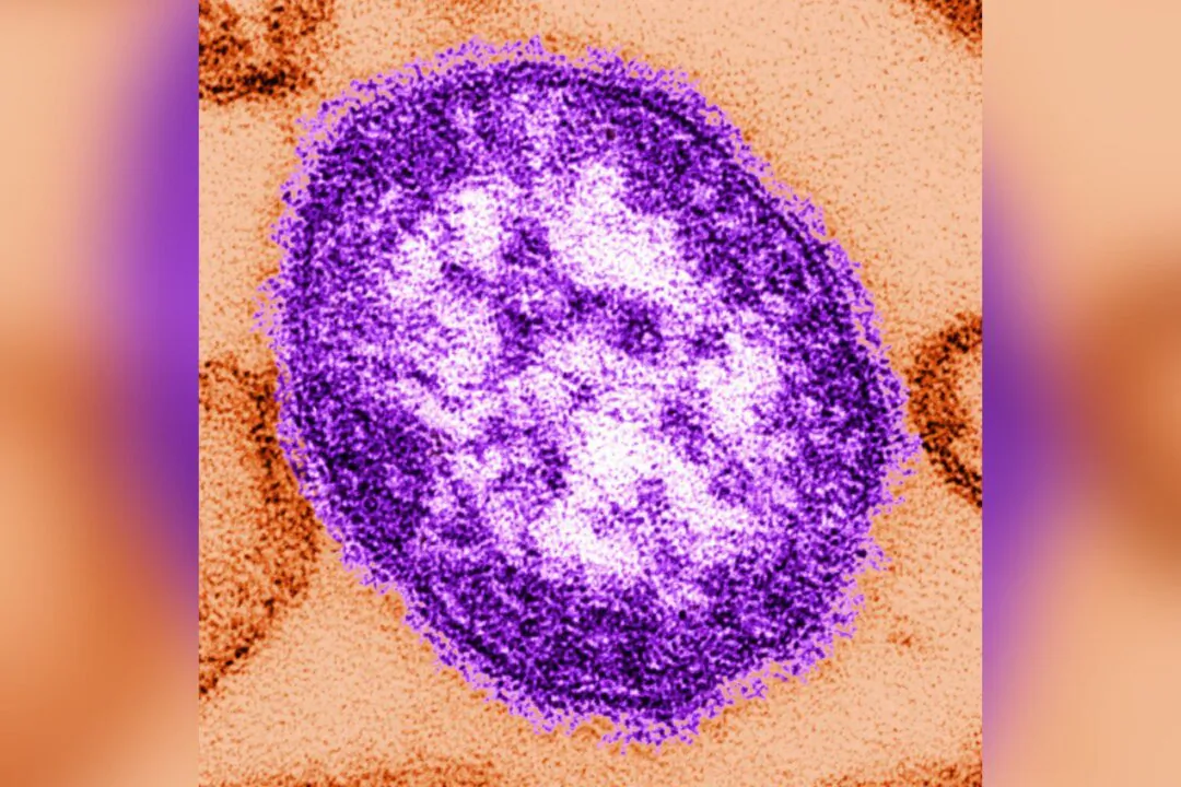 This undated image made available by the Centers for Disease Control and Prevention on Feb. 4, 2015, shows an electron microscope image of a measles virus particle. (The Canadian Press/AP-Cynthia Goldsmith/Centers for Disease Control and Prevention via AP) 