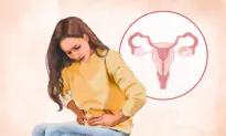 Ovarian Cancer: The 'Silent' Gynecological Disease With 2 Main Causative Factors