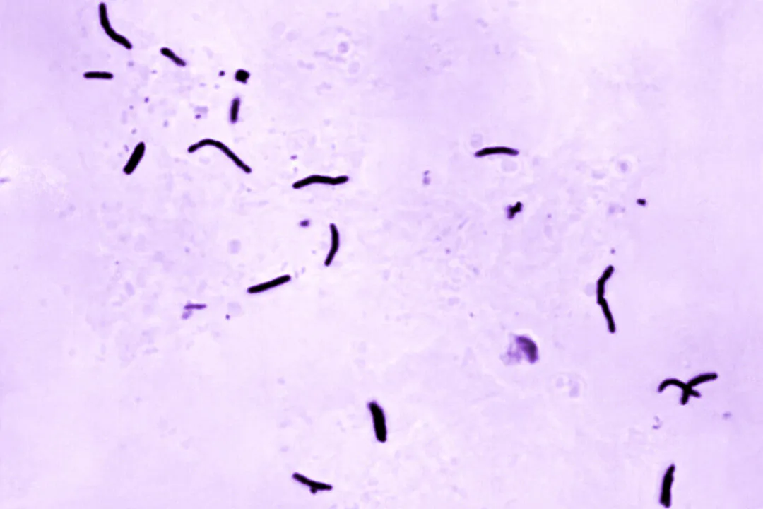 Mycobacterium tuberculosis bacilli, the organism responsible for causing the disease tuberculosis, in a microscope photo in 1966. (Elizabeth S. Mingioli/CDC via AP)
