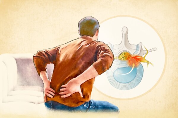 Symptoms of a Herniated Disk