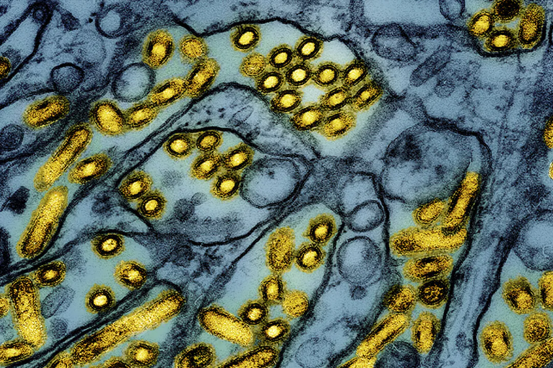 A colorized electron microscope image released on March 26, 2024 shows avian influenza A H5N1 virus particles (yellow), grown in Madin-Darby Canine Kidney (MDCK) epithelial cells (blue). (CDC/NIAID via AP)