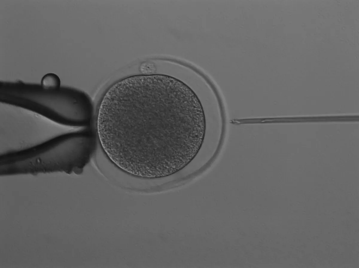 Marsupial conservation has taken a crucial leap forward, following the first successful production of a kangaroo embryo through in vitro fertilization (IVF). (Courtesy of University of Queensland)