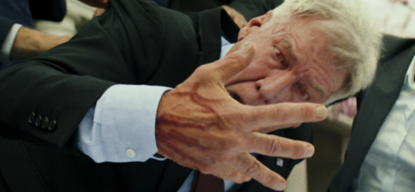 man with white hair who hands are turning red in Captain America: Brave New World.