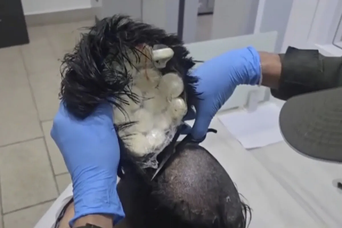 Colombian police catch a man smuggling packets of cocaine under his toupee at the airport in Cartagena, Colombia, on Feb. 24, 2025, in this screenshot taken from a video. (Via Colombian National Police)