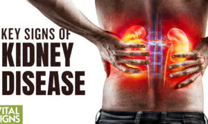 Key Signs of Kidney Disease and Steps to Prevent It
