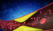 Protecting Your Heart: How High Cholesterol and Emotional Health Affect Atherosclerosis