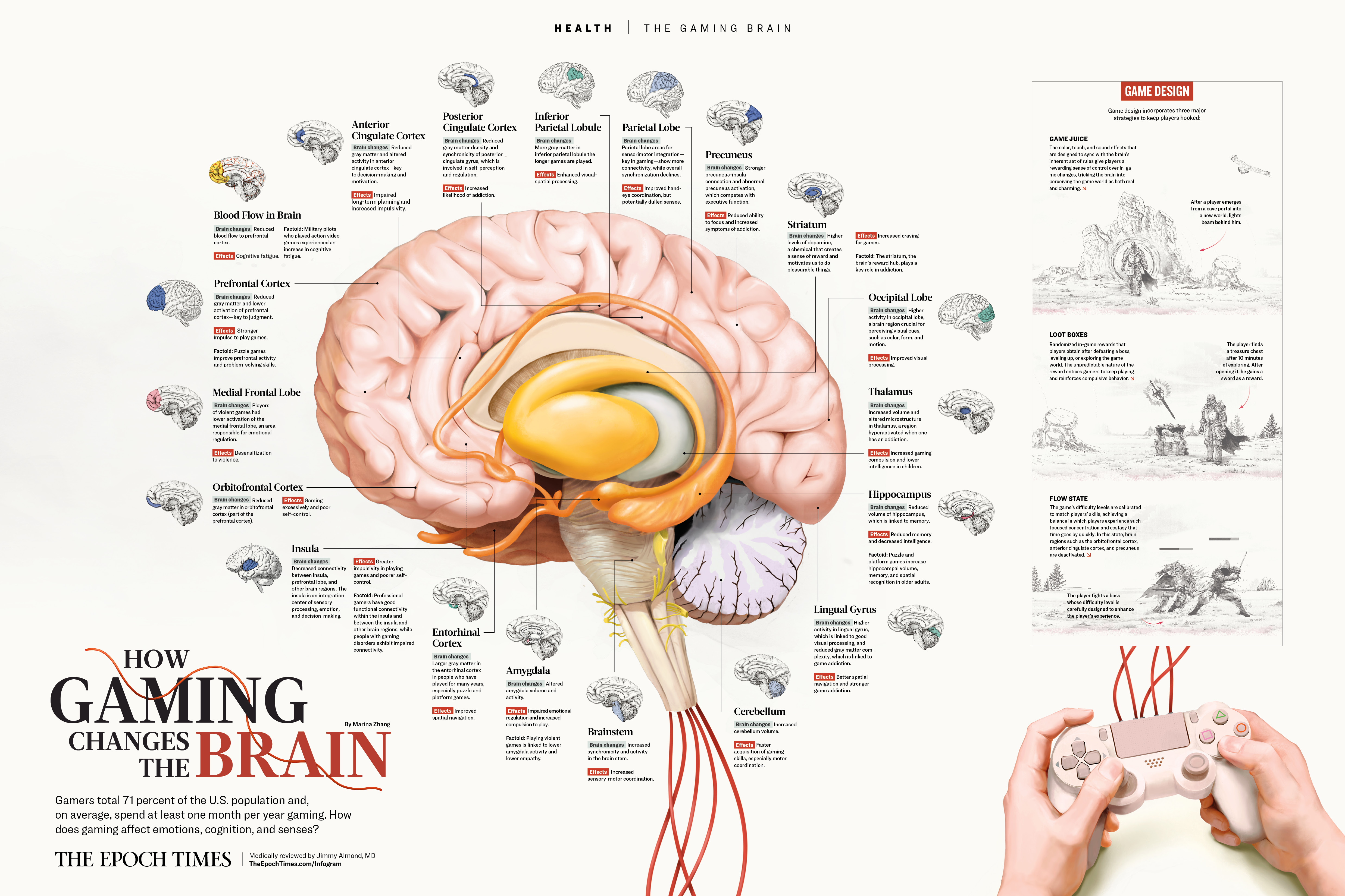 INFOGRAPHIC: How Gaming Changes the Brain