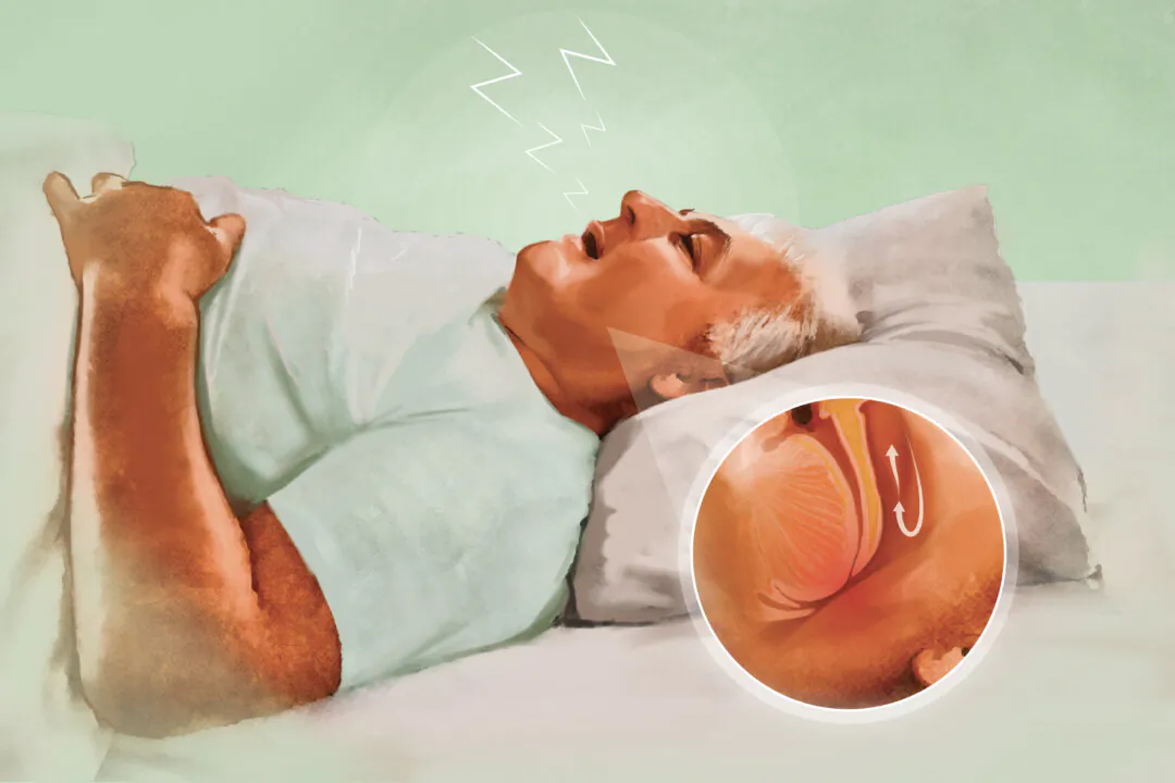 Frequent, loud snoring is a key warning sign of obstructive sleep apnea. (Illustration by The Epoch Times, Shutterstock)