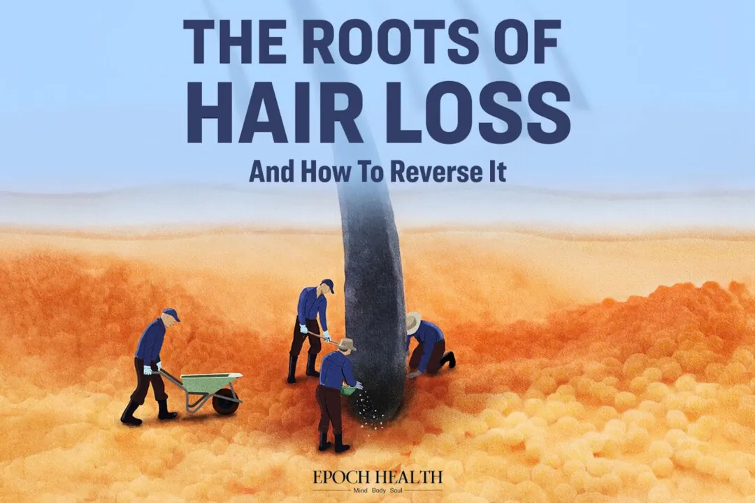The Roots of Hair Loss