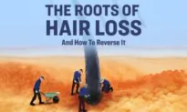 The Roots of Hair Loss