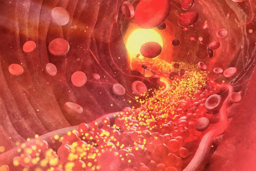 Beyond Cholesterol Lies a New Approach to Heart Health